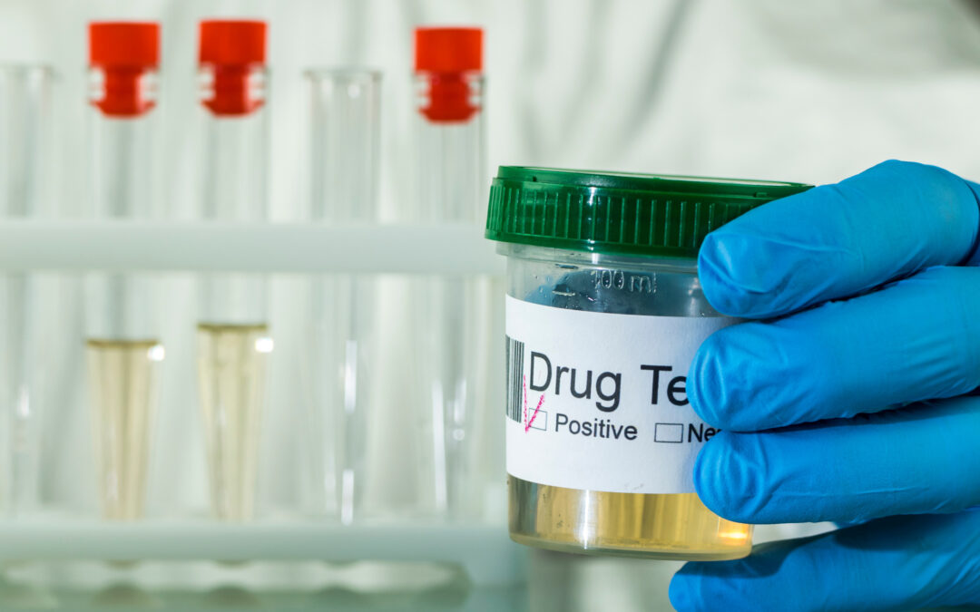 What Happens If You Fail a Drug Test at Work and What to Do Next