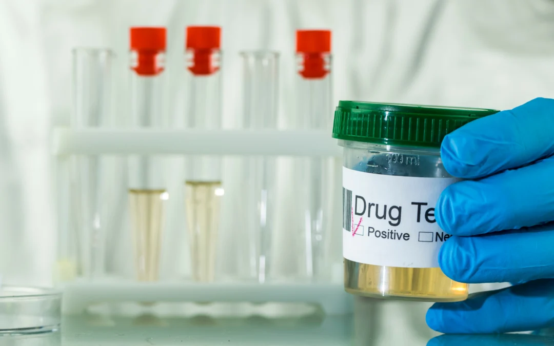 Does Kratom Show Up on a Drug Test? What You Need to Know