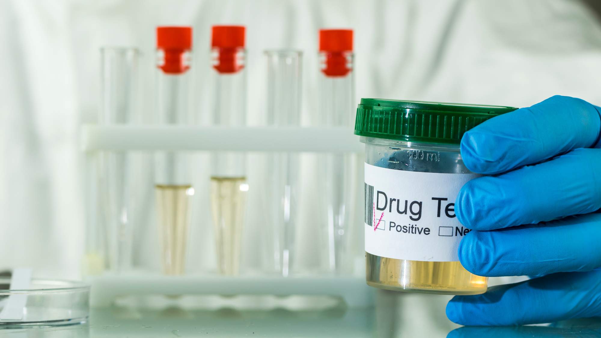 Drug Testing Drug Testing
